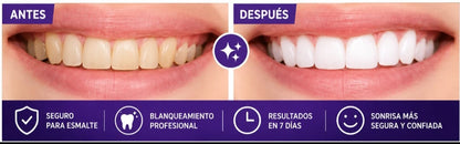 TIRA BLANQUEADORA DE DIENTES PORTATIL